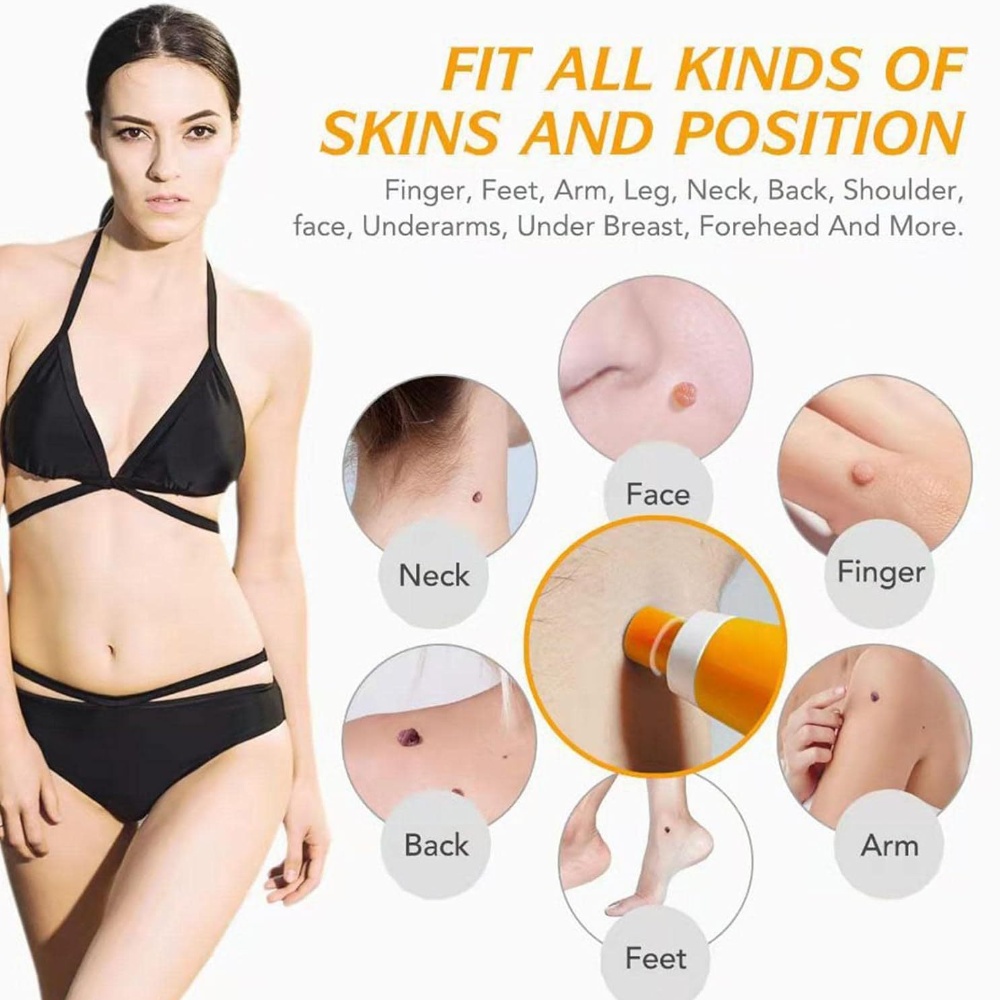 Kit Penghilang Kutil Kulit Oto - Skincare Ingredients Checker ulasan dan harga