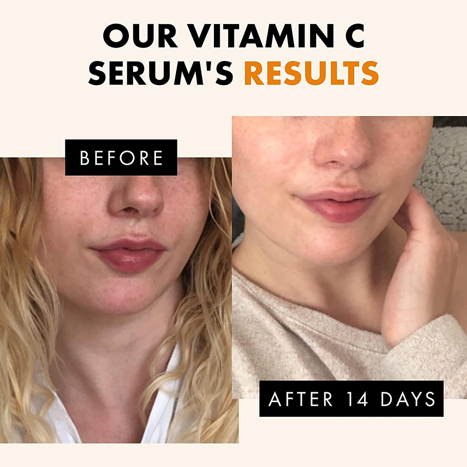 Serum Wajah Vitamin C 120ml, S - Skincare Garnier ulasan dan harga
