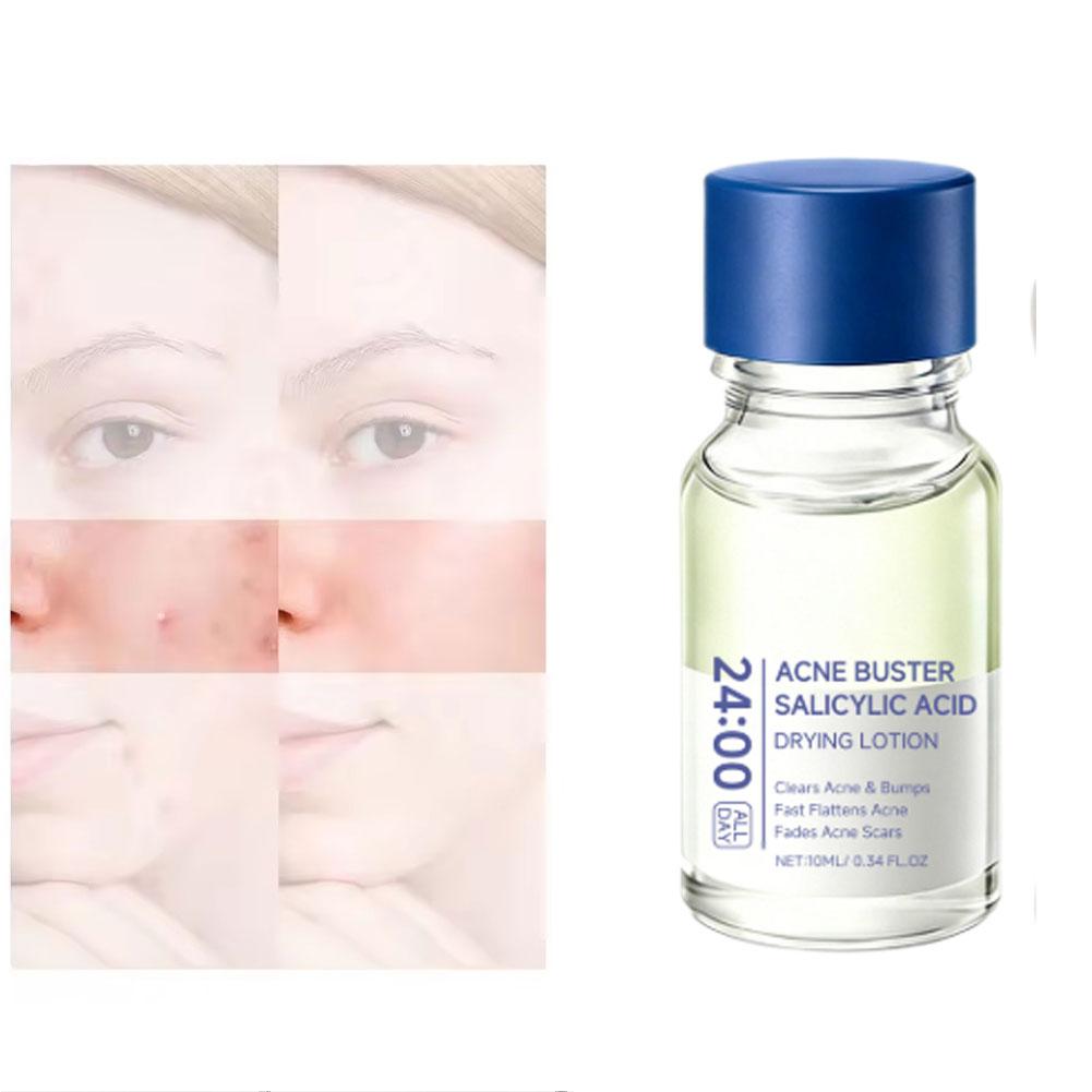 Lotion Perawatan Esens Asam Sa - Skincare Salicylic Acid ulasan dan harga