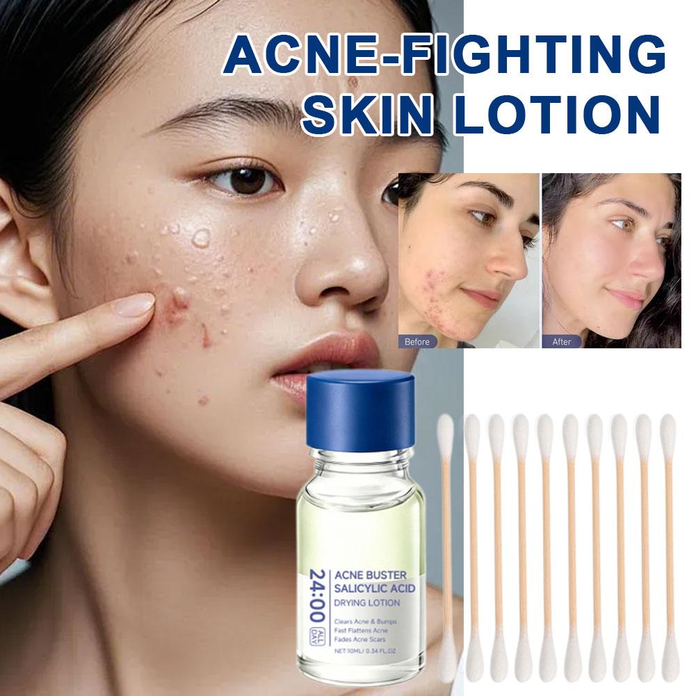 Lotion Perawatan Esens Asam Sa - Skincare Salicylic Acid ulasan dan harga