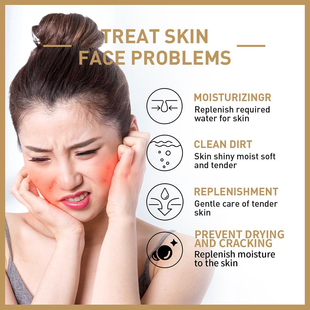 Rice Face Toner pelembab hidra - Skincare Garnier ulasan dan harga