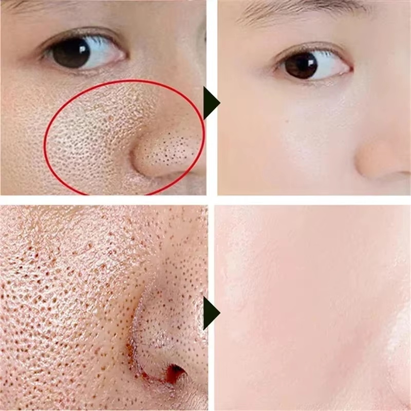 Krim Pengecil Pori Asam Salisi - Skincare Salicylic Acid ulasan dan harga